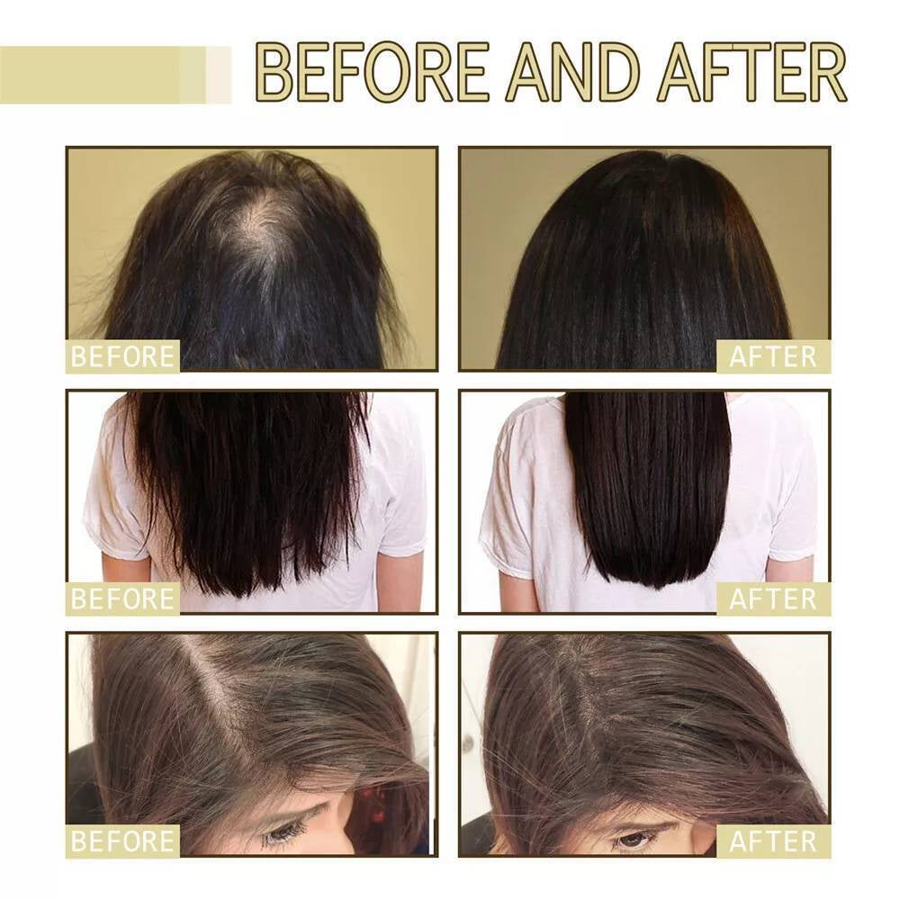 Natural hair growth oil | Veganic | 60ml